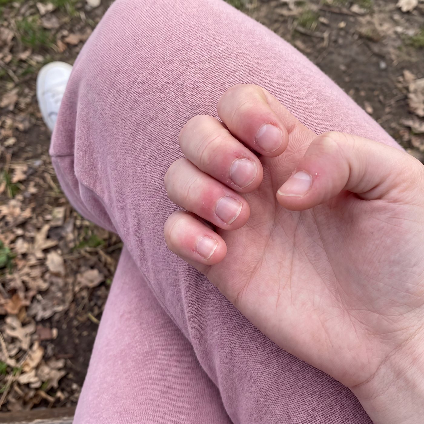 Your Hands Are Already Asking For It